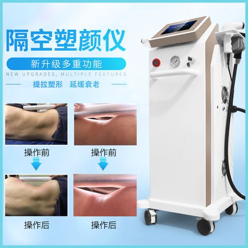 特價溶脂瘦身 碎脂機